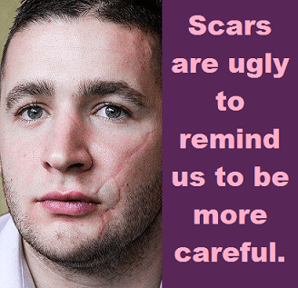 scars-with-words